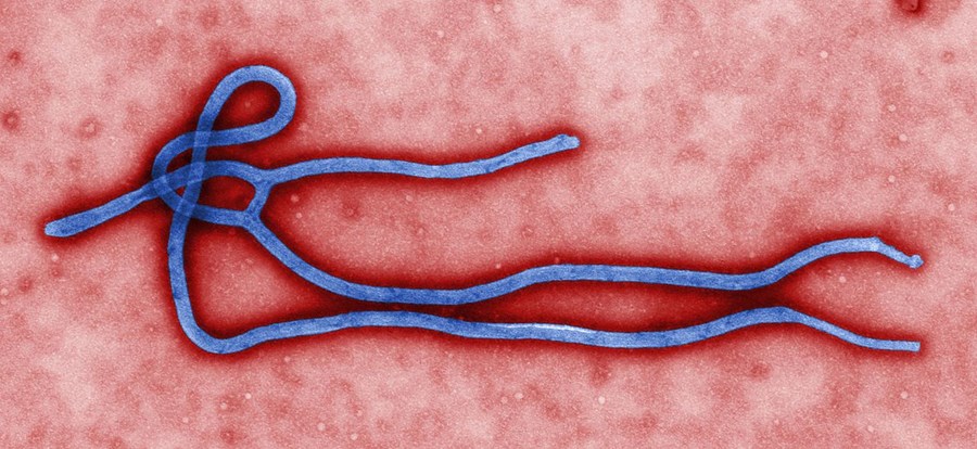 Agência africana de saúde anuncia surto de Ebola no Congo, com 65 mortes suspeitas
