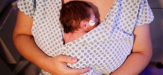 Calculadora de idade para bebês prematuros passa a integrar sistema do SUS