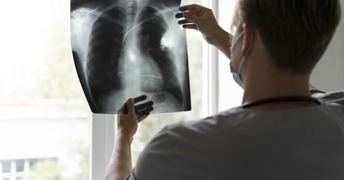 Anvisa aprova novo medicamento para câncer de pulmão com mutação genética